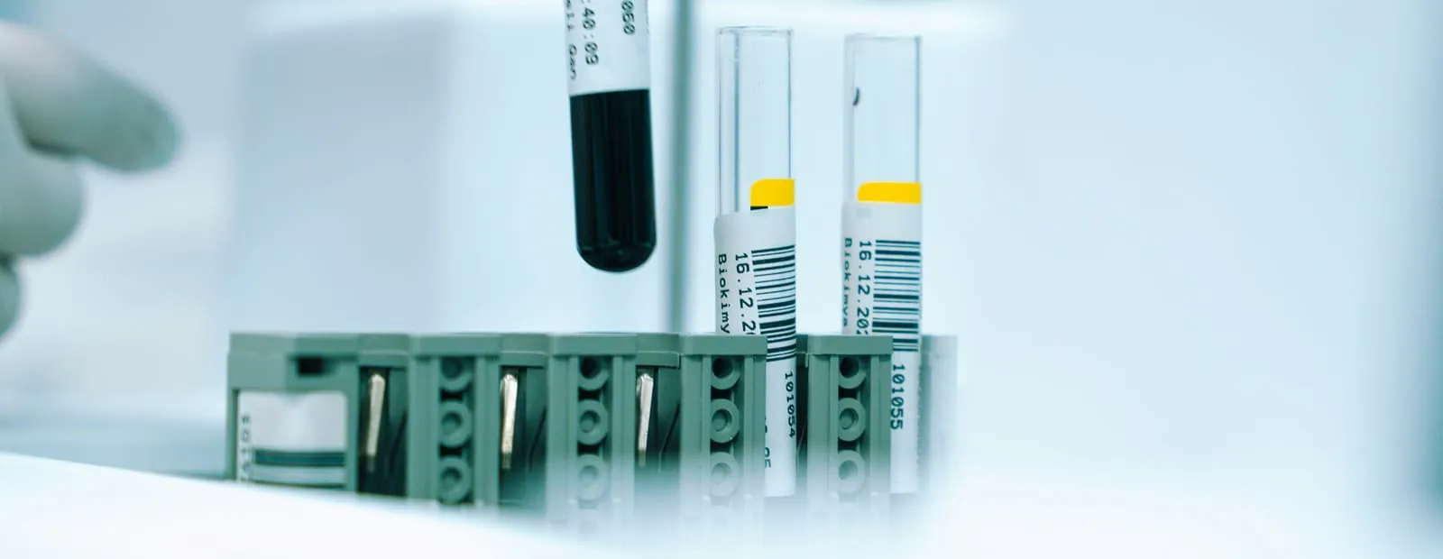 Thyroid antibodies: TPO, TgAb and TRAb/TSI
